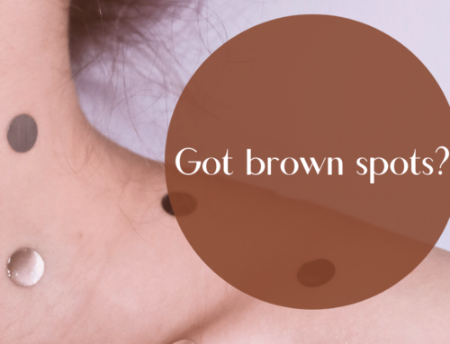 Brown Spots On Your Skin? | Here’s What You Need to Know